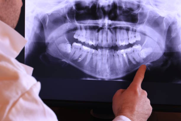 Dentist for Dental Trauma in NJ